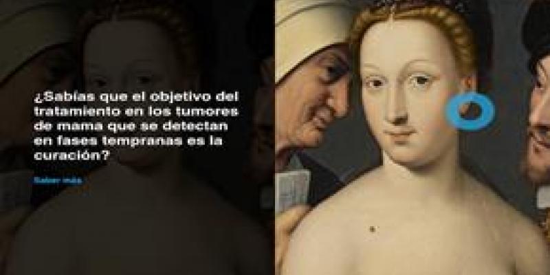 El cáncer de mama necesita fomentar la investigación/ campaña Thyssen y FECMA La investigación del cáncer de mama