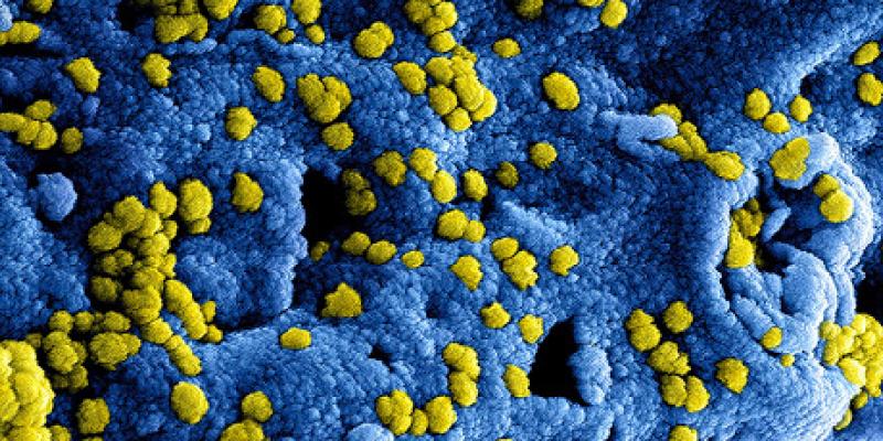 ¿Cuál es la letalidad de la infección por Covid-19? La tasa de letalidad del coronavirus se sitúa entre el 0,8 y el 1,1 %