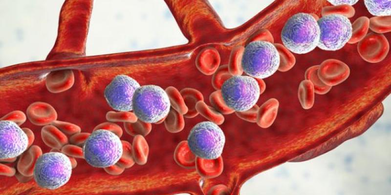Leucemia linfoblástica aguda