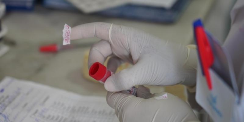 Imagen de las manos de un sanitario que maneja material médico en Cabo Verde, país que acaba de declararse libre de malaria 