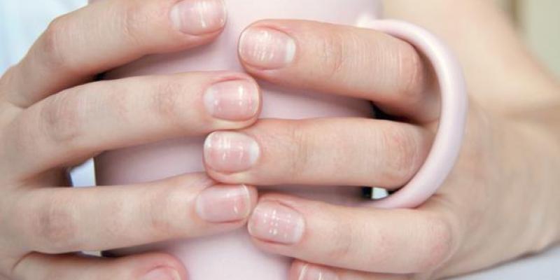 Imagen de uñas con manchas blancas/ABC Por qué salen las manchas blancas en las uñas