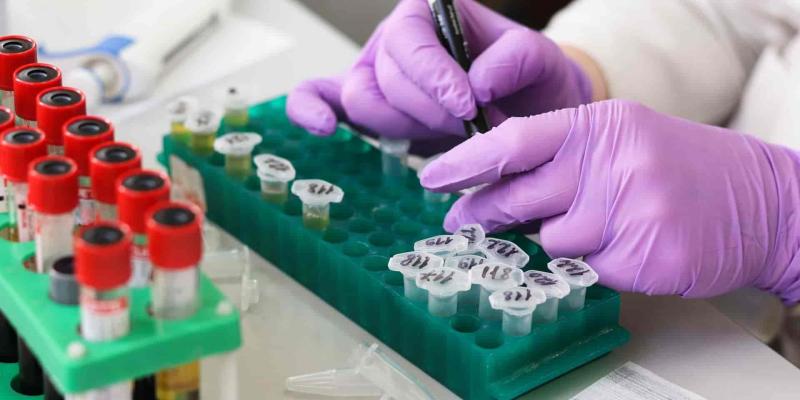 Imagen de unas pruebas científicas/Público Científicos de Barcelona descubren las células que causan la recaída en el cáncer de colon