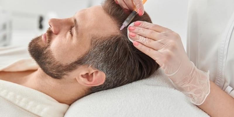 Imagen de un tratamiento capilar/MyCapil Mesoterapia capilar