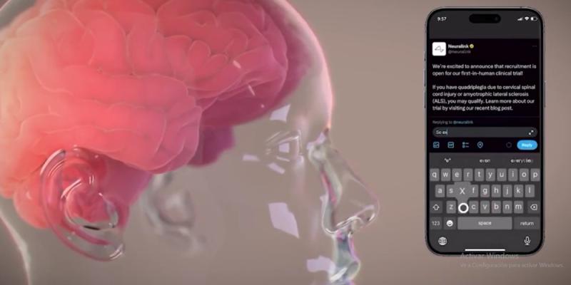 Neuralink hace su primera prueba en humanos 