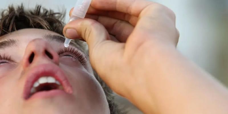 Una persona se aplica en el ojo colirio - Foto: Getty Images Una persona se aplica en el ojo unas gotas oculares, en una imagen de archivo.