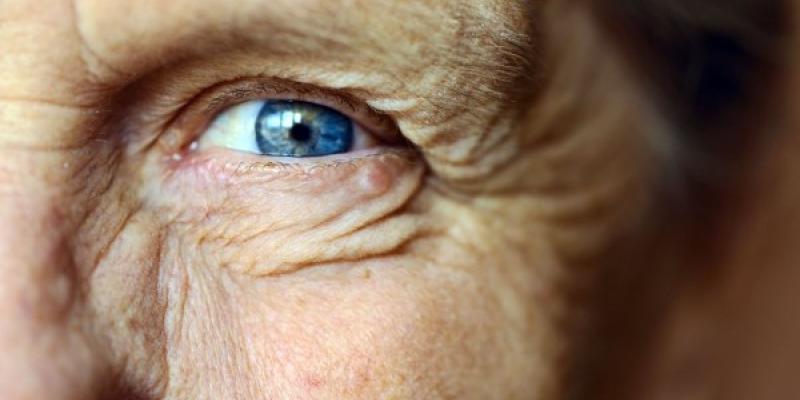 Envejecimiento y pérdida de visión Visión y envejecimiento