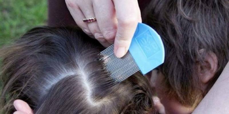 Los piojos, sus mitos y verdades Piojos en el pelo