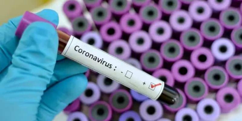 Transfusiones de plasma contra el coronavirus Los contagiados por COVID-19 podrían curarse con transfusiones de plasma.