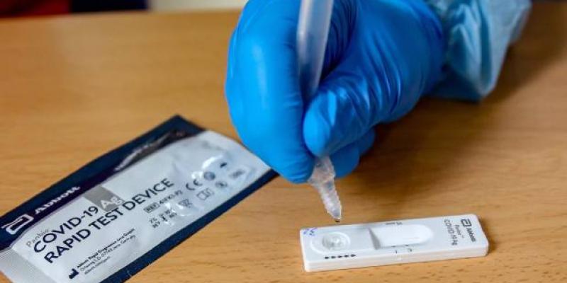 Los test de antígenos rondan entre los 5 y 12 euros la unidad Test de antígenos/Redacción médica
