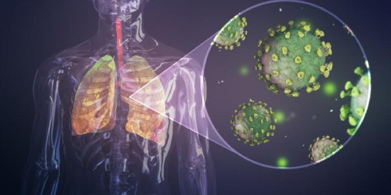 Así perjudica el COVID-19 a los pulmones. De qué manera perjudica el COVID-19 a los pulmones.