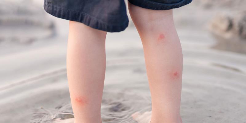 ¿Son aconsejables las pulseras repelentes de insectos? ¿Es aconsejable utilizar las pulseras repelentes de insectos en verano?