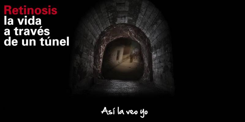 Retina Begisare Visión de túnel en una persona con Distrofia Hereditaria de Retina