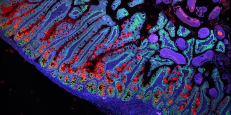 Microesferas para detectar de forma no invasiva las enfermedades gastrointestinales