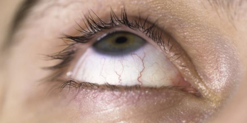 Imagen de un ojo/Envatoelements Consejos para la sequedad ocular