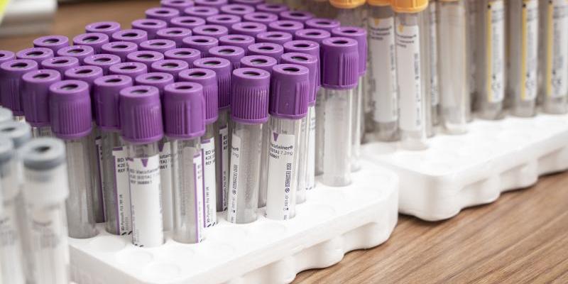 Sanidad alerta de que la tasa de positividad en los test ronda el 14% en enero, el doble que hace un mes Tubos análisis de sangre / Servimedia