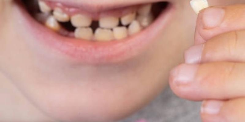 Imagen de un niño con un diente/Sermade Sermade renueva su programa para mejorar la salud bucodental en personas con TEA