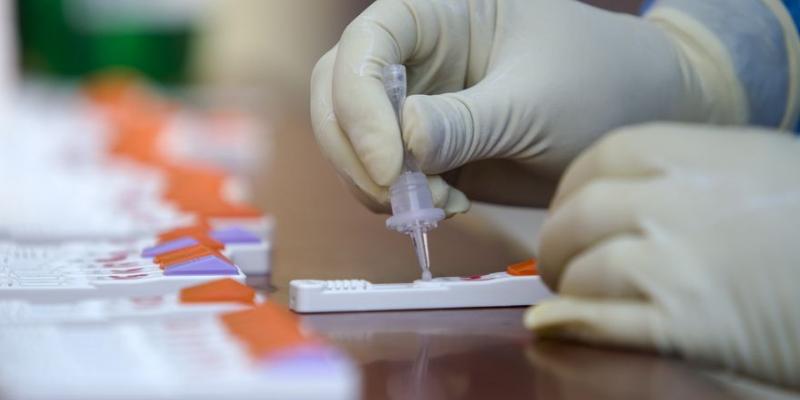 Los test de antígenos cuestan alrededor de 30 euros en los laboratorios privados Test de covid/La Nueva España