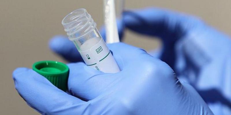 Test de diagnóstico de coronavirus Los sanitarios reclaman hacer más test de diagnóstico a los profesionales.