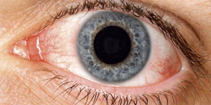 PrensaRank Imagen de un ojo