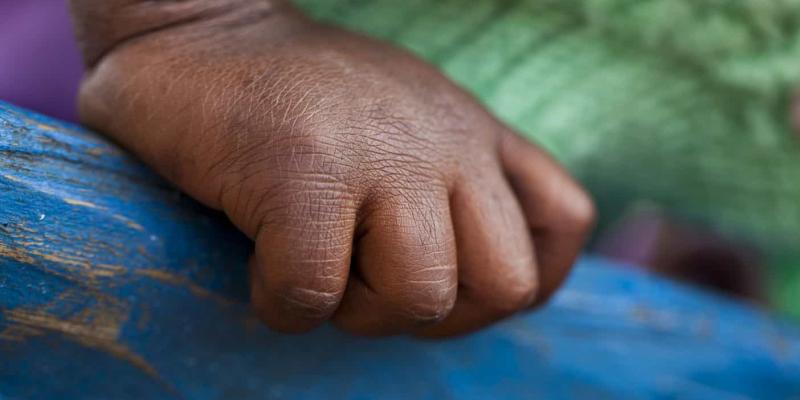 Imagen de una mano/Envatoelemennts Pobreza infantil en Uruguay