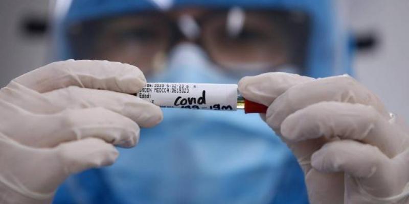 Pedro Sánchez se muestra esperanzado con la vacuna del Covid El mundo se mantiene en incertidumbre mientras varios laboratorios trabajan en la vacuna contra la covid-19. Foto: Juan Pablo Rueda. EL TIEMPO