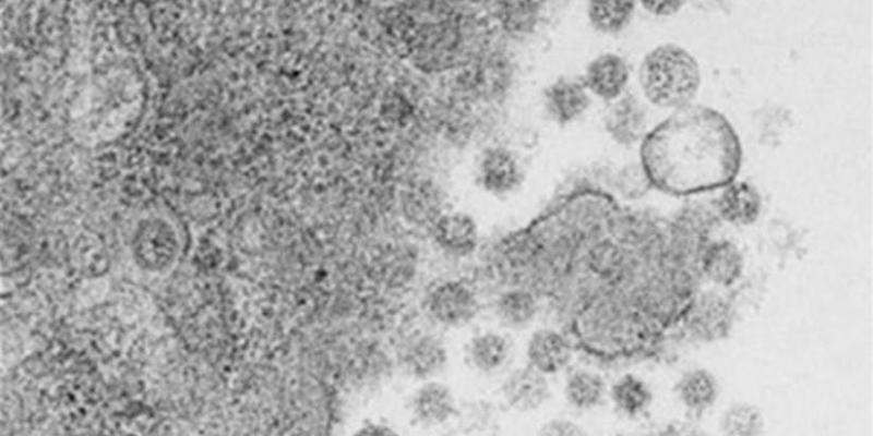 Virus del SARS-CoV-2 saliendo de las células infectadas 