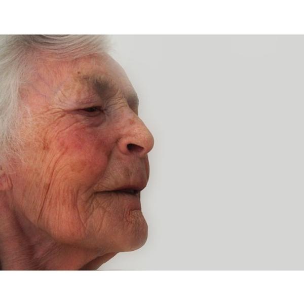 Mujer mayor con Alzhéimer