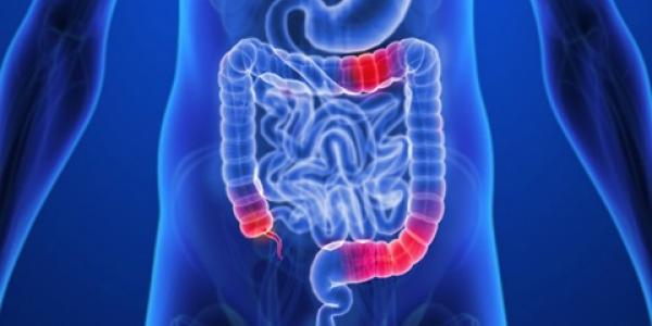 Enfermedad de Crohn, causas y tratamiento