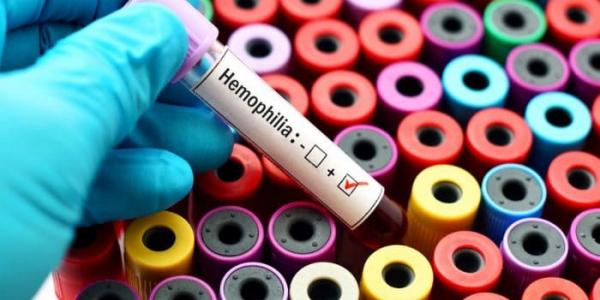 Hemofilia