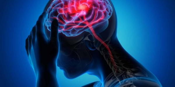 El Covid-19 aumenta el riesgo de accidente cerebrovascular