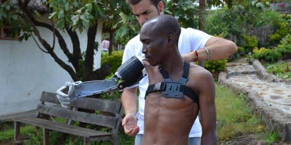 El fundador de Ayúdame 3D colocando una prótesis en África