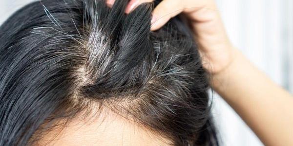 Las canas y su posible relación con evitar el cáncer