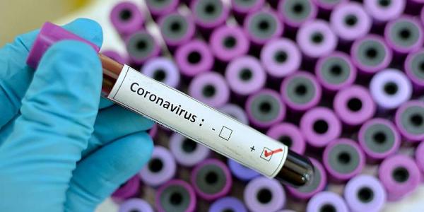 Mientras descubren la vacuna contra el coronavirus, la infección se propaga.