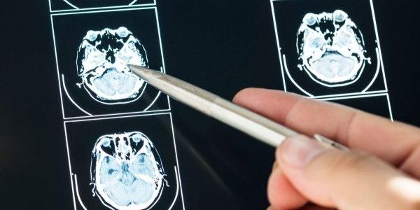Una exploración médica del cerebro 