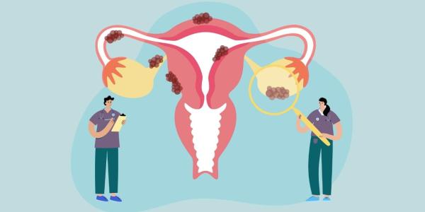 Dibujo sobre la endometriosis