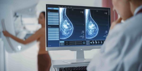 Las mamografías aumentan el riesgo de falso positivo en cáncer de mama