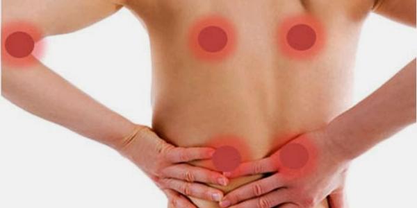 ¿Cuáles son los síntomas de la fibromialgia?