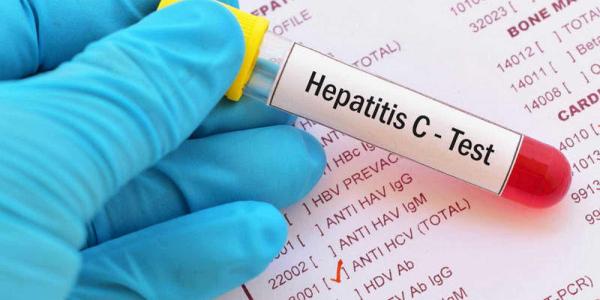 La hepatitis C crece en España