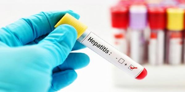 Muestra de sangre con Hepatitis