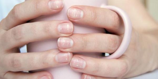 Por qué salen las manchas blancas en las uñas