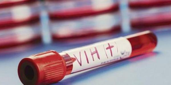 Alertan sobre una nueva variante del VIH