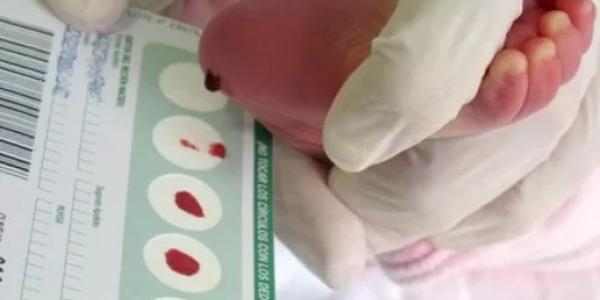 Bebé pasando por el cribado neonatal o prueba del talón