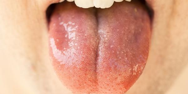 Nuestra saliva y sus características