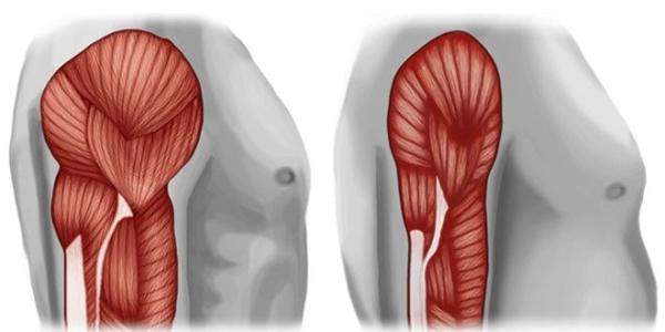 Sarcopenia, afección en los músculos