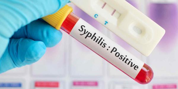 Un estudio advierte de la "inaceptablemente alta" prevalencia de la sífilis entre hombres homosexuales