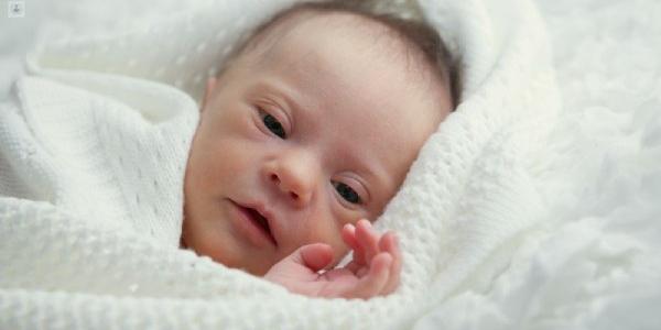 Bebé con síndrome de Edwards