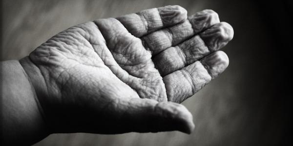 Arrugas / Pixabay Manos con arrugas