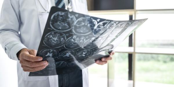 Un médico sostiene en sus manos una radiografía del cerebro