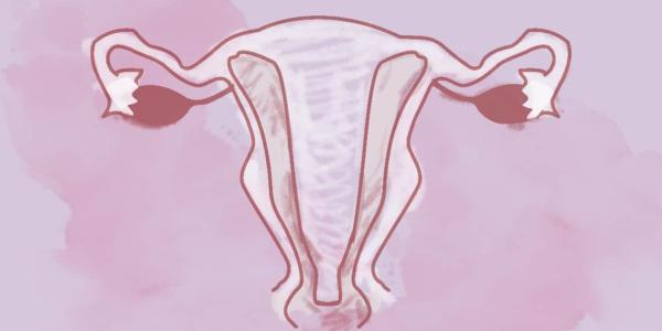Útero arcuato, una malformación uterina