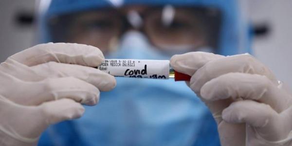 El mundo se mantiene en incertidumbre mientras varios laboratorios trabajan en la vacuna contra la covid-19.  Foto: Juan Pablo Rueda. EL TIEMPO
